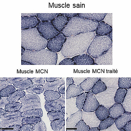 Coupes transversales de muscles marqués par immunohistochimie pour révéler la position des mitochondries, une organelle essentielle à la production d’énergie dans les cellules. © Q. Giraud/IGBMC 