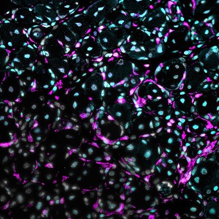 Les macrophages (magenta) infiltrent la lésion pour débarrasser le muscle des débris cellulaires. Le récepteur des glucocorticoïdes (cyan), dans les noyaux (blanc), contribue à la régulation de l'inflammation. © S. Souali-Crespo/IGBMC