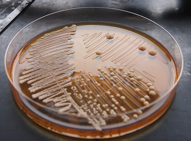 Joseph Schacherer effectue ses travaux sur un organisme modèle : la levure Saccharomyces cerevisiae. ©Jing Hou