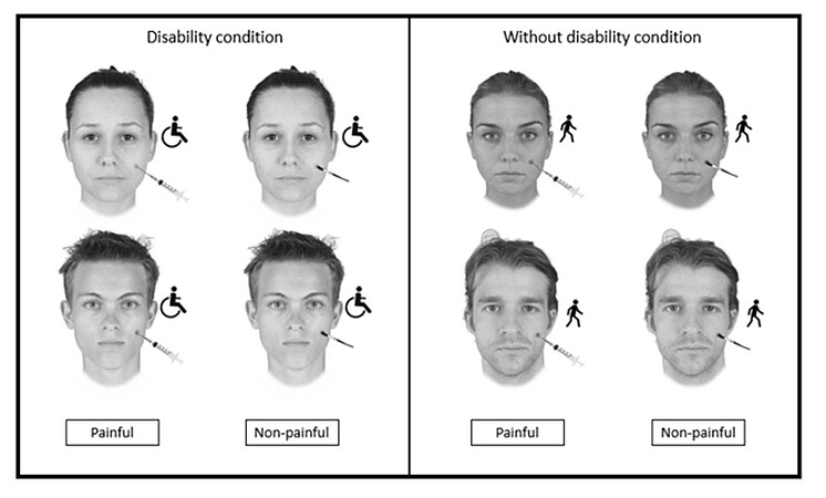 Exemple de stimuli utilisé pour l’étude sur la réaction empathique à la douleur sur des publics porteurs de handicap (Granjon et al. 2023)