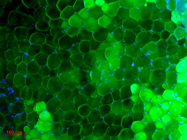 Tissu adipeux viscéral de souris marqué en fluorescence. Les noyaux sont colorés en bleus. Crédit : Vincent Marion. 