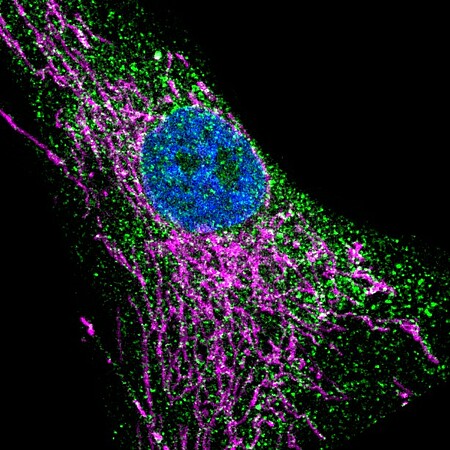 Image microscopique d’un fibroblaste de peau. Le récepteur IP3R3 est marqué en vert, les mitochondries en magenta et le noyau, en bleu. ©DR