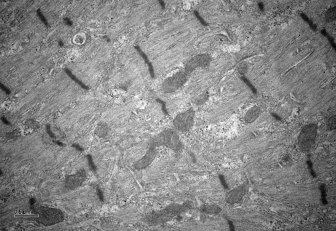 Coupe longitudinale de muscle de souris modèle de myopathie myotubulaire en microscopie électronique. ©Messaddeq N, IGBMC