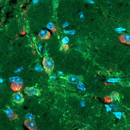 Les chercheurs ont identifié une population de neurones de l'habenula impliquée dans les effets aversifs du sevrage aux opioïdes (vert). Le ciblage du récepteur orphelin GPR139 (rouge) réduit l'activité de ce circuit cérébral. ©Chiara Ebner