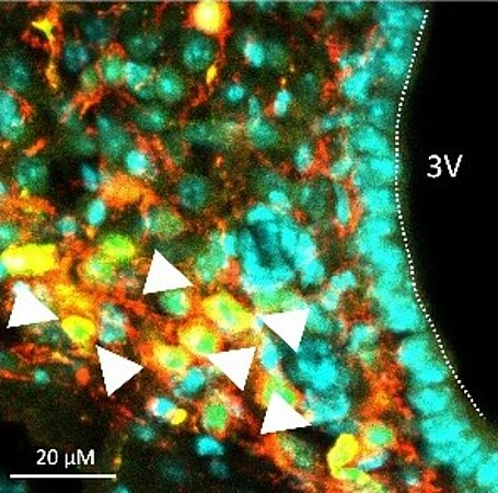 Visualisation par immunofluorescence des noyaux cellulaires (cyan), de la protéine CaMK1D surexprimée (vert) et des neurones orexigènes (rouge) dans le noyau arqué hypothalamique. ©Karl Vivot/IGBMC