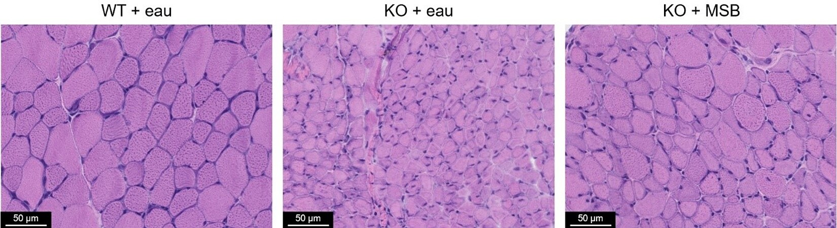 Coupes de muscles de souris sauvage (WT) ou dépourvues de MTM1 (KO), sans (eau) ou avec une supplémentation en précurseur de vitamine K. © Charlotte Gineste/IGBMC 