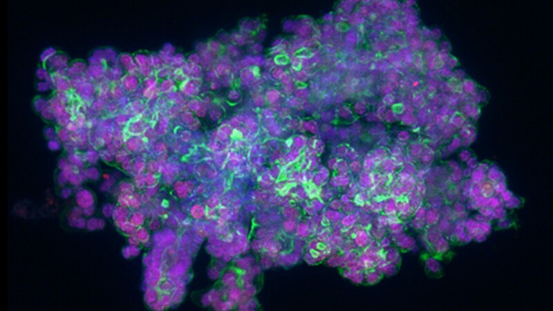 Organoïde après marquage par immunofluorescence sur différents marqueurs. ©Marlène Deschuyter/LBP