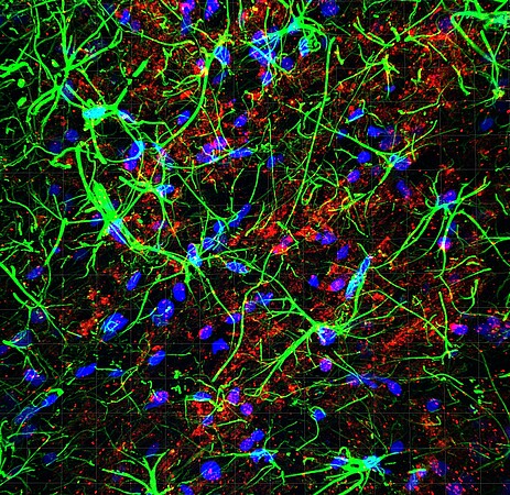 Images de microscopie confocale. Les astrocytes sont révélés par marquage vert, les récepteurs de l’ocytocine par une fluorescence rouge. Les noyaux cellulaires par une fluorescence bleue. Crédit Alexandre Charlet