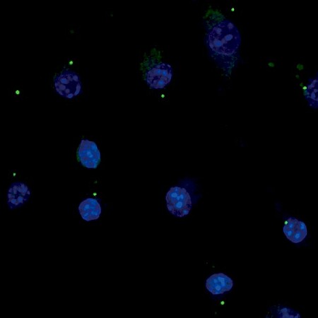 Visualisation par immunofluorescence des specks ASC (vert) dans la lignée humaine monocytaire THP-1 en réponse à l’activation de l’inflammasome NLRP3 en présence d’un agoniste du canal mécanosensible PIEZO1. Les noyaux des monocytes sont mis en évidence par DAPI. © R.Ricci/IGBMC