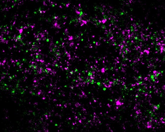 Image de microscopie à super résolution du VIH-1 Gag (vert) et des domaines de sphingomyéline (magenta). © Nario Tomishige