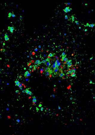 Visualisation par immunofluorescence d’endosomes (bleu), de récepteurs de l’inflammasome NLRP3 (vert) et de l’accumulation de lipides (rouge) dans des macrophages. Crédits Rossella Venditti et Antonella de Matteis, Tigem, Naples
