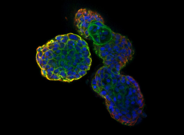 Coloration fluorescente de tumoroïde © Sophie FOPPOLO / LBP / CNRS Images