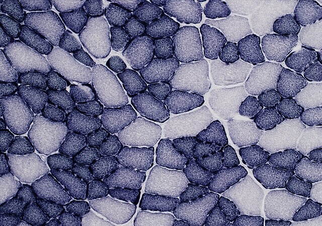 Coupe transversale du muscle tibial antérieur d’une souris porteuse de mutations dans le gène BIN1 ayant reçu le traitement de thérapie génétique © IGBMC, Jacqueline Ji 